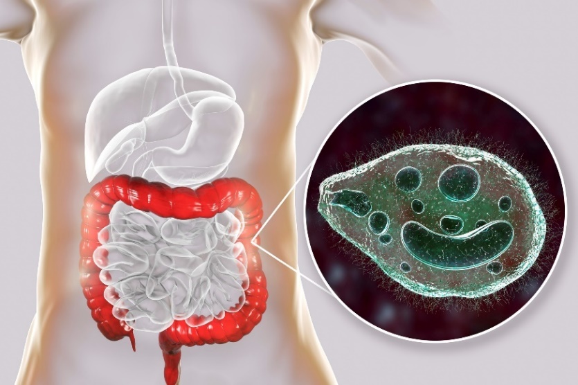 Balantidium coli - inimese seedetrakti jämesooli nakatav parasiit.