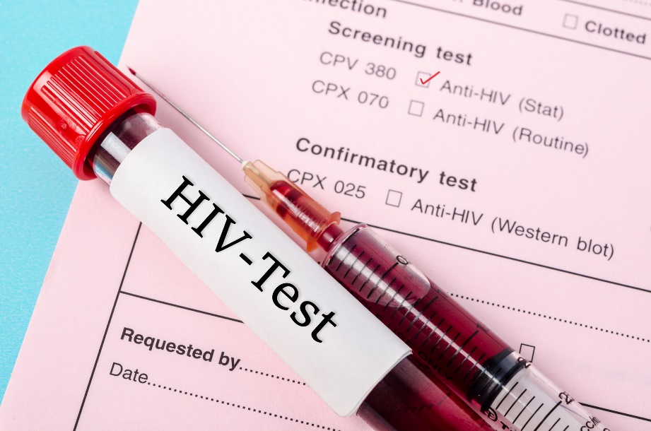 Diagnostiline test HIV-vastaste antikehade esinemise tuvastamiseks patsiendi vereproovis