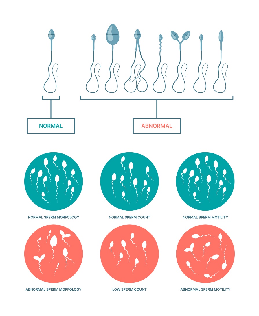 Spermatosoidide füsioloogiline ja ebanormaalne seisund. Spermatosoidide morfoloogia, arv ja liikuvus.