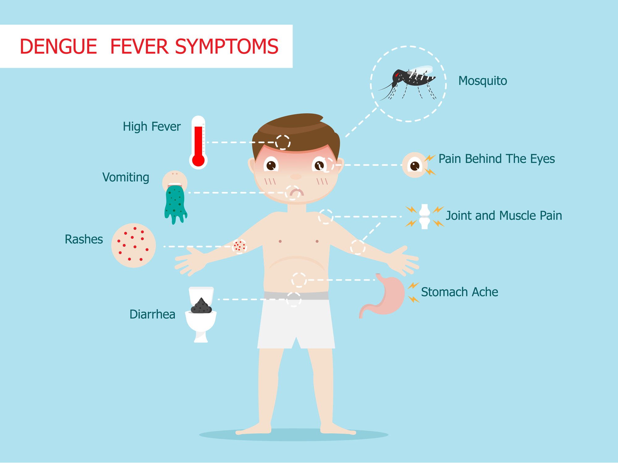 Dengue'i palaviku sümptomid