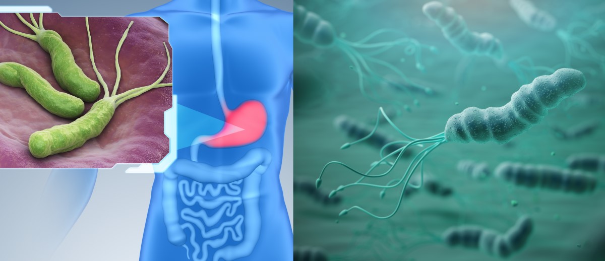 Helicobacter pylori koloniseerib mao limaskesta ja on gastriidi, haavandite ja vähi riskitegur.