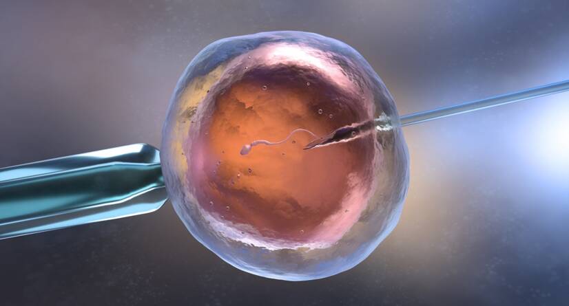 Kehaväline viljastamine IVF. Allikas: Getty Images