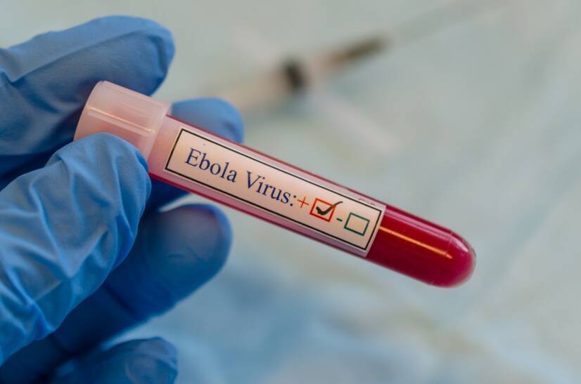 Ebola: Millised on sümptomid?