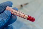 Ebola: Millised on sümptomid?