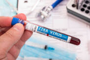 Zika-viirus: mis see on, kuidas see levib ja millised on sümptomid?